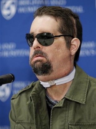 Face transplant recipient Dallas Wiens, of Fort Worth, Texas, takes questions from members of the media during a news conference at Brigham And Women's Hospital, in Boston.
