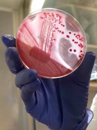 An employee of the laboratory at Hamburg Eppendorf hospital shows a bacterial culture of the EHEC bacterium.