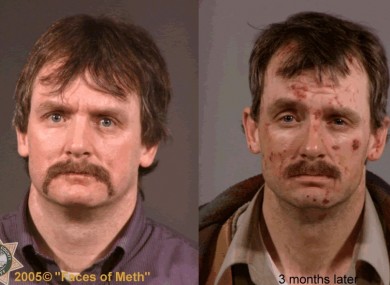 Faces of Crystal Meth